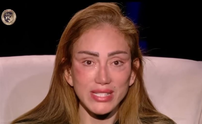اتهمه بتشويه وجهها.. إلهام شاهين تنشر فيديو صلح ريهام سعيد مع طبيبها